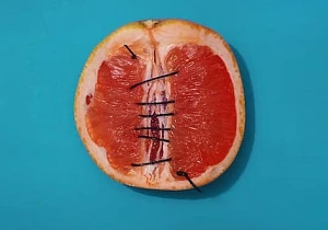 #TheOtherVulva